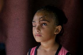 Palestinian Girl Injured During School Bombardment - Gaza