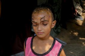 Palestinian Girl Injured During School Bombardment - Gaza