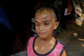 Palestinian Girl Injured During School Bombardment - Gaza