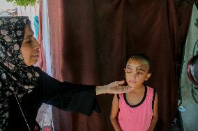 Palestinian Girl Injured During School Bombardment - Gaza