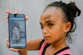 Palestinian Girl Injured During School Bombardment - Gaza