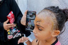 Palestinian Girl Injured During School Bombardment - Gaza