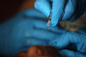 Palestinian Child Receives Polio Vaccine at UN Center in Gaza Amid Conflict