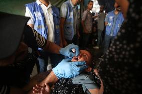 Palestinian Child Receives Polio Vaccine at UN Center in Gaza Amid Conflict