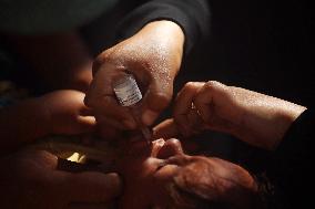 Palestinian Child Receives Polio Vaccine at UN Center in Gaza Amid Conflict