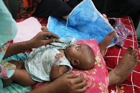 Dengue Epidemic In Bangladesh