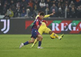 CALCIO - Serie A - Juventus FC vs Bologna FC