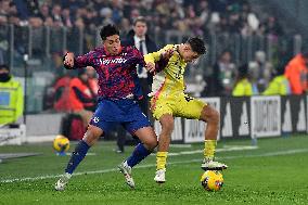 CALCIO - Serie A - Juventus FC vs Bologna FC