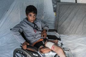 13-Year-Old Palestinian Faces Uncertain Future After Losing Leg - Gaza