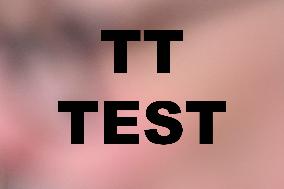 TT NEWS AGENCY TEST 1