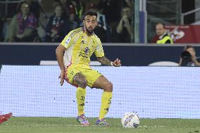 CALCIO - Serie A - Bologna FC vs Juventus FC
