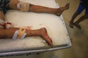 Victims of The Israeli Bombing - Gaza