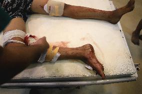 Victims of The Israeli Bombing - Gaza