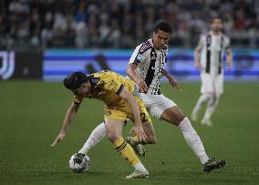 CALCIO - Serie A - Juventus FC vs Udinese Calcio