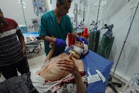 Israel Strikes Nuseirat Refugee Camp - Gaza