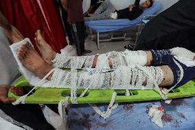 Israel Strikes Nuseirat Refugee Camp - Gaza