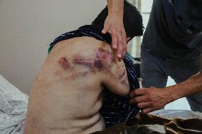 Jericho Arrest Leads To Hospitalization - Palestine