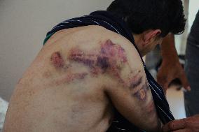 Jericho Arrest Leads To Hospitalization - Palestine