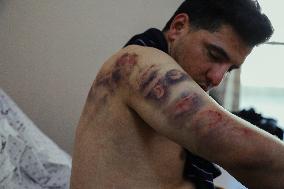 Jericho Arrest Leads To Hospitalization - Palestine