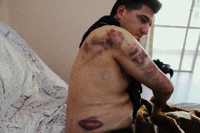 Jericho Arrest Leads To Hospitalization - Palestine