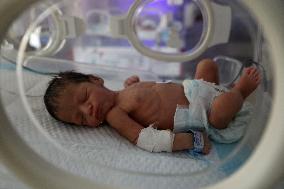 Premature Baby Treated at Al-Aqsa Hospital