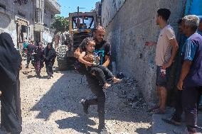 Gaza Airstrike Aftermath - Injured Child in Jabalia