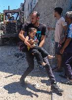 Gaza Airstrike Aftermath - Injured Child in Jabalia