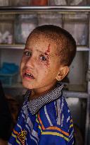 Gaza Airstrike Aftermath - Injured Child in Jabalia