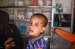 Gaza Airstrike Aftermath - Injured Child in Jabalia