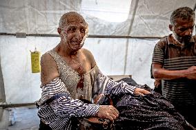 Gazans Killed and Wounded - Gaza City