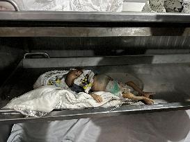 Infant Dies of Malnutrition in Hospital - Khan Yunis