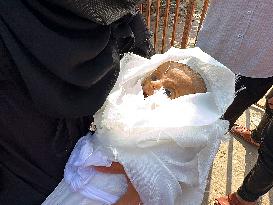Infant Dies of Malnutrition in Hospital - Khan Yunis