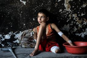 Gaza City Addressing Disability Issues - Gaza