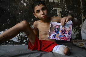 Gaza City Addressing Disability Issues - Gaza