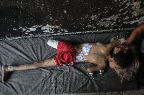 Gaza City Addressing Disability Issues - Gaza
