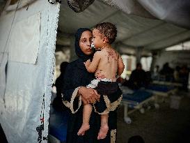 Gaza Children Skin Diseases - Khan Yunis