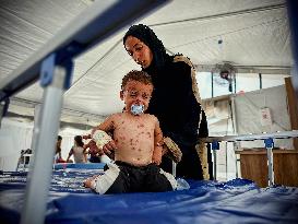 Gaza Children Skin Diseases - Khan Yunis