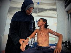 Gaza Children Skin Diseases - Khan Yunis