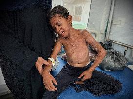 Gaza Children Skin Diseases - Khan Yunis
