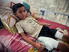 Child Loses Arm in Israel Gaza Conflict