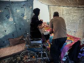 Child Loses Arm in Israel Gaza Conflict