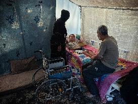 Child Loses Arm in Israel Gaza Conflict