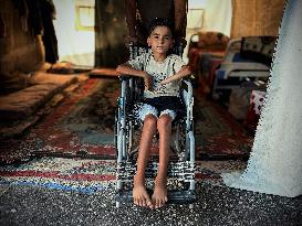 Child Loses Arm in Israel Gaza Conflict