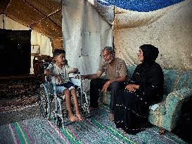 Child Loses Arm in Israel Gaza Conflict