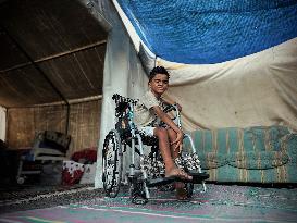 Child Loses Arm in Israel Gaza Conflict