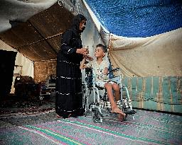 Child Loses Arm in Israel Gaza Conflict