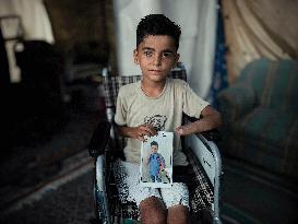Child Loses Arm in Israel Gaza Conflict