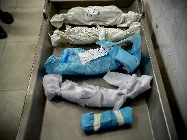 Children Die Amid Malnutrition in Khan Yunis - Palestine