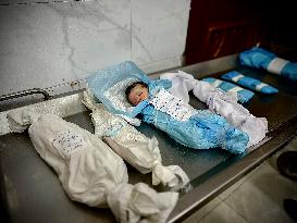 Children Die Amid Malnutrition in Khan Yunis - Palestine