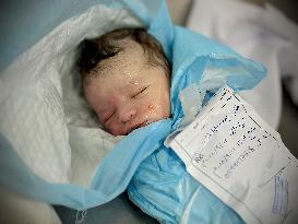 Children Die Amid Malnutrition in Khan Yunis - Palestine